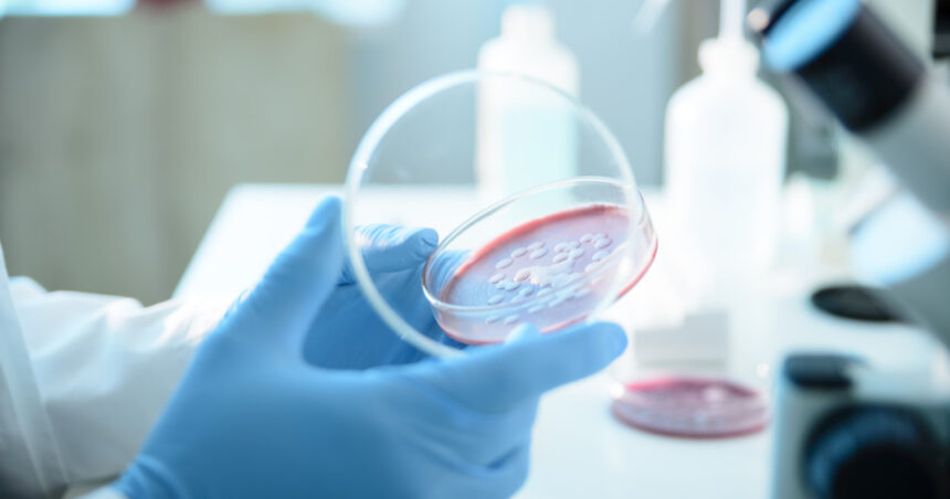 ce este serratia marcescens bacteria descoperita la spitalul sfanta maria din iasi unde au murit sase copii 68d6951d8e44f