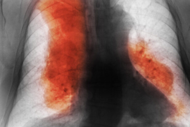 numarul deceselor cauzate de cancer ar urma sa creasca semnificativ pana in 2050 cele mai frecvente si cele mai mortale studiu 68d500d29a5c7