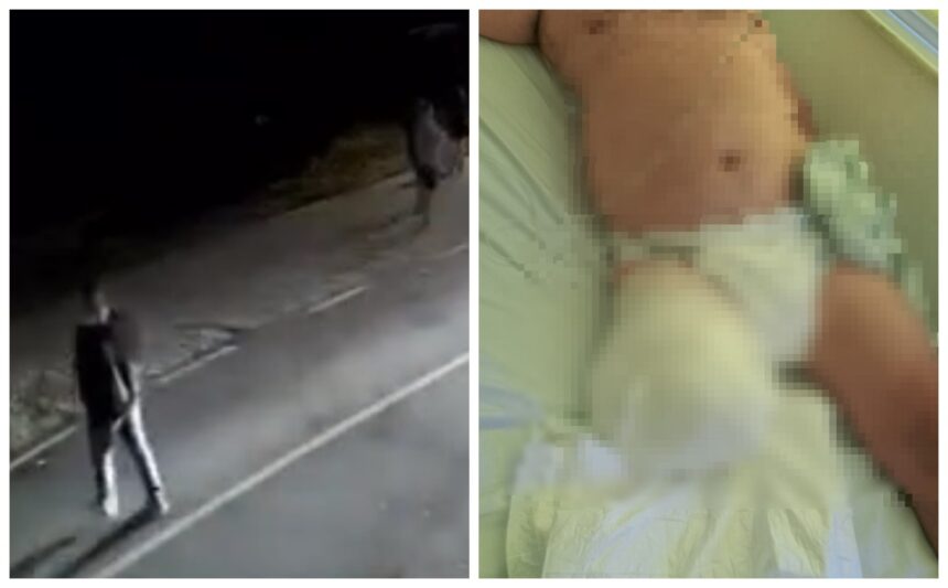 video imagini cu puternic impact emotional din timpul producerii accidentului de la oltina unde un barbat a ramas fara un picior 68c7c5170b07e