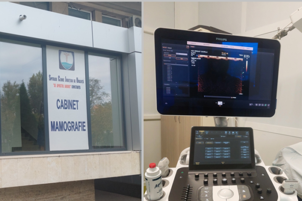 foto spitalul judetean constanta a achizitionat un ecograf unic in romania pentru depistarea precoce a cancerului de san 6917849696d6b