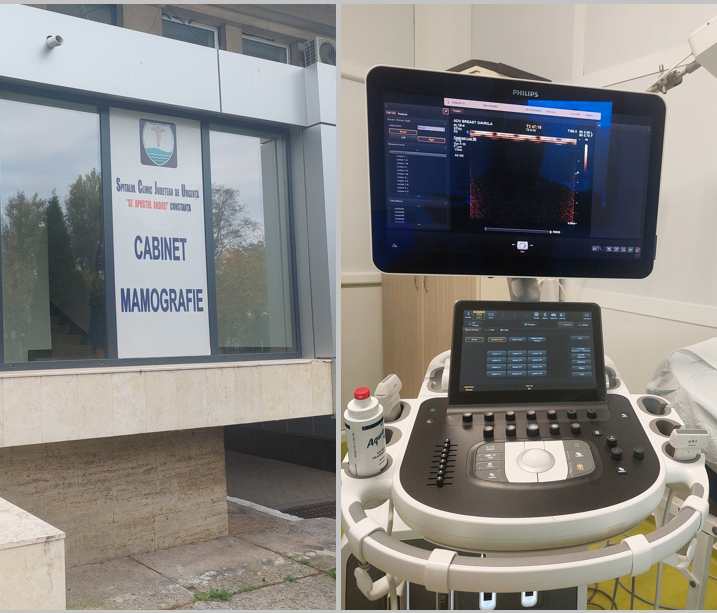 foto spitalul judetean constanta a achizitionat un ecograf unic in romania pentru depistarea precoce a cancerului de san 6917849696d6b
