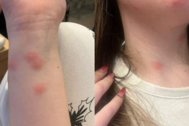 video o tanara a ajuns la spital dupa ce a fost muscata de plosnite intr un tren cfr familia a facut plangere 6922d3f4a59de