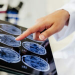 video premiera medicala la spitalul bagdasar arseni din bucuresti operatie pe creier cu pacientul treaz a fost foarte curajos 691c204e002ab