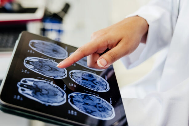 video premiera medicala la spitalul bagdasar arseni din bucuresti operatie pe creier cu pacientul treaz a fost foarte curajos 691c204e002ab