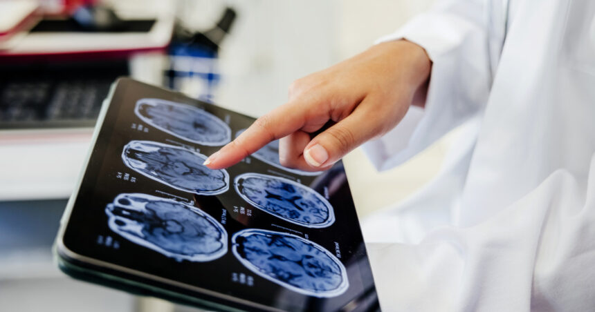 video premiera medicala la spitalul bagdasar arseni din bucuresti operatie pe creier cu pacientul treaz a fost foarte curajos 691c204e002ab