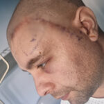 mihai un tanar din mangalia are nevoie urgenta de ajutor pentru a lupta cu boala nemiloasa care ii macina sanatatea 692e97438a0f1