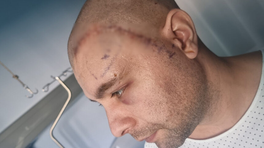 mihai un tanar din mangalia are nevoie urgenta de ajutor pentru a lupta cu boala nemiloasa care ii macina sanatatea 692e97438a0f1