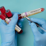 alerta in romania primul caz de virus chikungunya confirmat la un barbat venit din africa 697ca221a4342