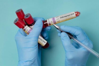 alerta in romania primul caz de virus chikungunya confirmat la un barbat venit din africa 697ca221a4342