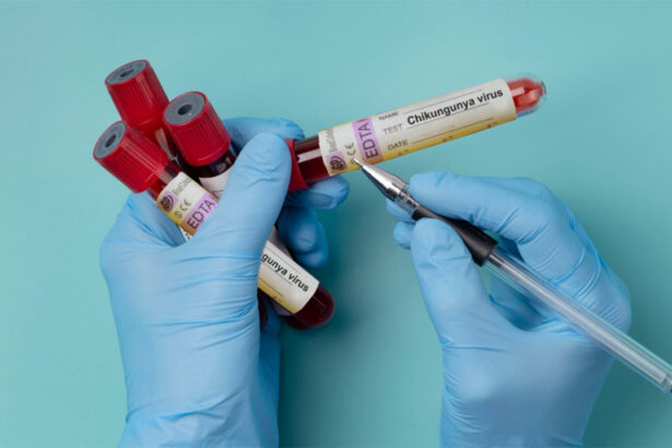 alerta in romania primul caz de virus chikungunya confirmat la un barbat venit din africa 697ca221a4342