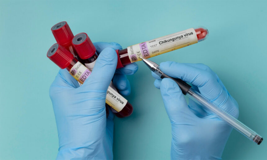 alerta in romania primul caz de virus chikungunya confirmat la un barbat venit din africa 697ca221a4342