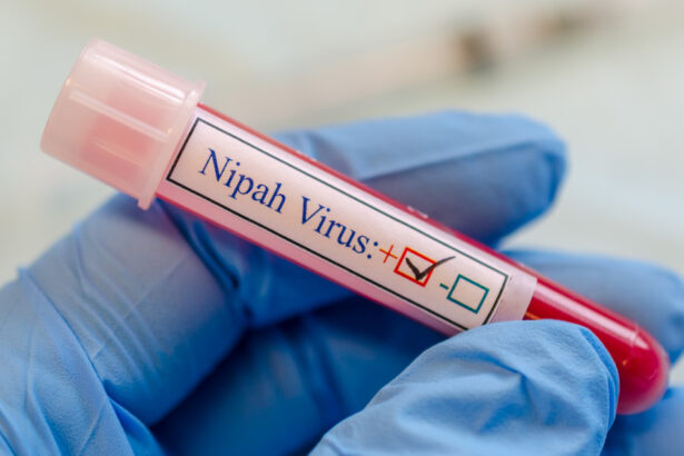 ce este virusul nipah care a declansat controale de securitate pe aeroporturile din asia ce riscuri exista pentru romania 6979f6835f6eb