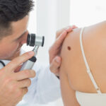 cum identifici alunitele cu risc de cancer dermatologii explica semnele importante care necesita evaluare urgenta 697482eed598d