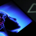 elon musk dezvaluie planurile neuralink pentru 2026 privind implanturile cerebrale 695788dbb2443