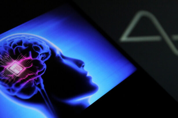 elon musk dezvaluie planurile neuralink pentru 2026 privind implanturile cerebrale 695788dbb2443