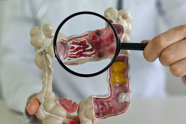 metoda prin care specialistii vor sa descopere de ce tot mai multi tineri sunt diagnosticati cu cancer o resursa unica 6963319b65be1