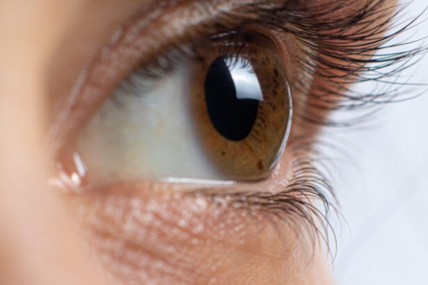 pacient in romania la stat sunt doar doi medici care redau vederea pacientilor prin transplant de cornee 6964e90f4804b