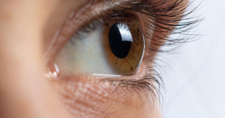 pacient in romania la stat sunt doar doi medici care redau vederea pacientilor prin transplant de cornee 6964e90f4804b