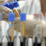 speranta noua in lupta cu cancerul pancreatic combinatia de trei medicamente care opreste boala 697de7ac8e214