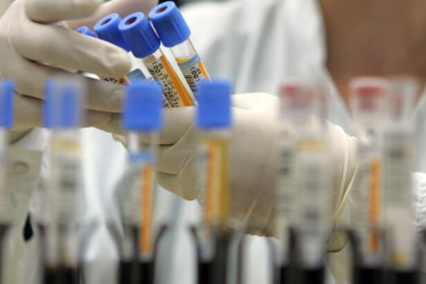 speranta noua in lupta cu cancerul pancreatic combinatia de trei medicamente care opreste boala 697de7ac8e214