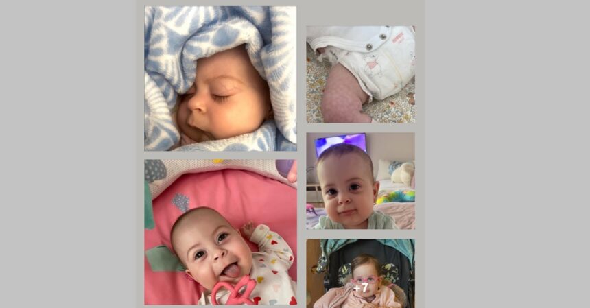 apel umanitar pentru elisa micuta de doi anisori cu cate 5 programari pe zi la medic pentru a supravietui si a merge mai departe cum puteti ajuta 69a2a1dc868c8