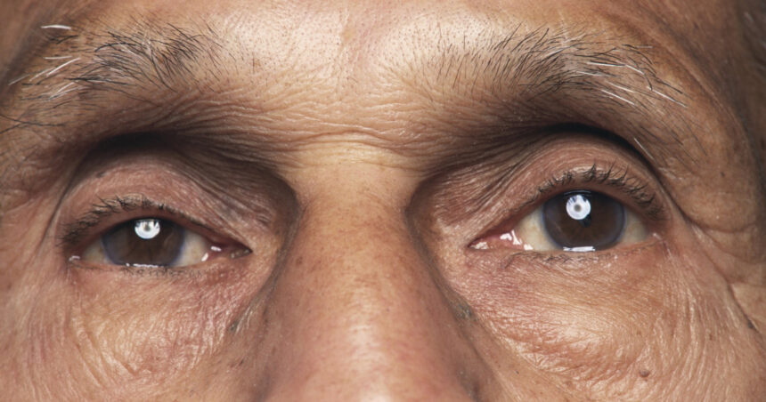 o bacterie prezenta in ochi asociata cu boala alzheimer si declinul cognitiv arata un nou studiu 69879d09f0461