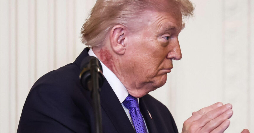 noi intrebari despre starea de sanatate a lui donald trump ce este pata rosie aparuta pe gatul presedintelui american 69a6086430fc3