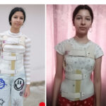 o afectiune crunta ii curbeaza coloana erikai in fiecare zi operatia este sansa mea va rog din suflet ajutati ma 69c109819d09e