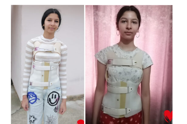 o afectiune crunta ii curbeaza coloana erikai in fiecare zi operatia este sansa mea va rog din suflet ajutati ma 69c109819d09e