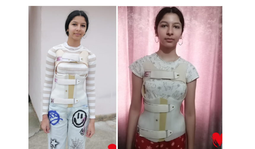 o afectiune crunta ii curbeaza coloana erikai in fiecare zi operatia este sansa mea va rog din suflet ajutati ma 69c109819d09e