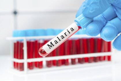 trei cazuri suspecte de malarie la copii dupa o calatorie in africa anuntul ministrului sanatatii 69c155375b0cd