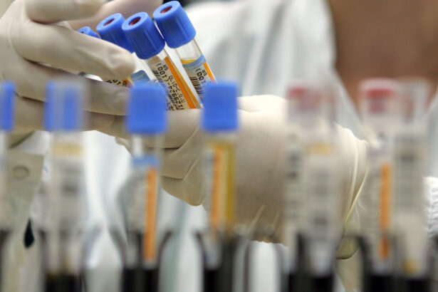 un studiu dezvaluie cele 37 de proteine din sangele centenarilor legate de o viata mai lunga si mai sanatoasa 69b2880b218b1