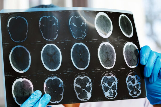 asociatiile de pacienti cer interventia ministerului sanatatii si cnas dupa scaderea cu 47 a investigatiilor de monitorizare 69cf92eeb9c84