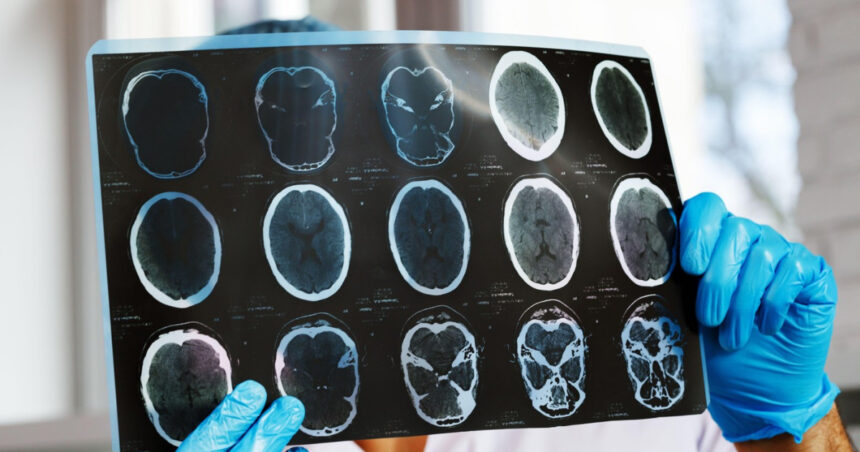 asociatiile de pacienti cer interventia ministerului sanatatii si cnas dupa scaderea cu 47 a investigatiilor de monitorizare 69cf92eeb9c84