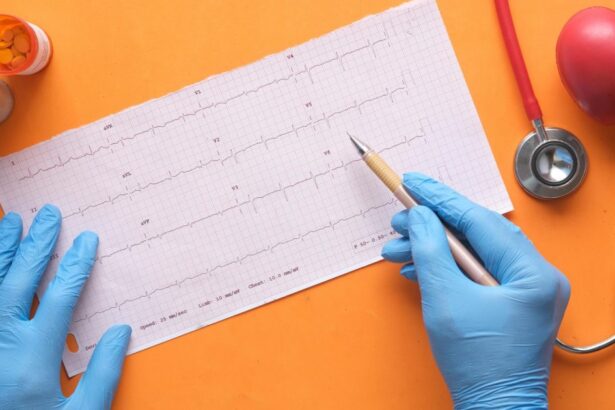 controalele cardiace utile si pentru sanatatea oaselor 69cd5d7d4e4fd