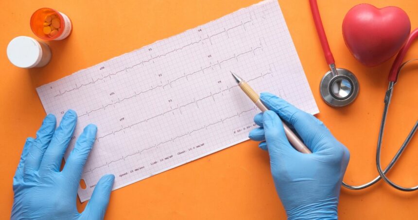 controalele cardiace utile si pentru sanatatea oaselor 69cd5d7d4e4fd
