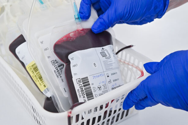 pacient mort dupa o transfuzie cu sange incompatibil asistent ati trimis in judecata pentru ucidere din culpa 6a199ba4a33d1