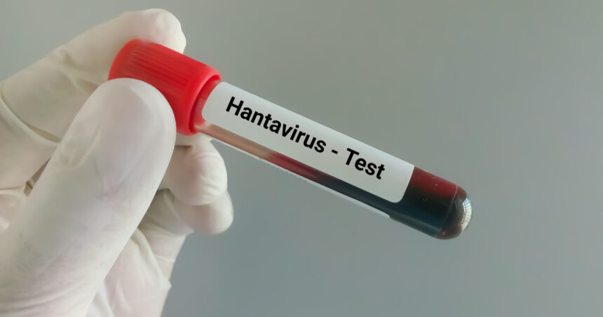suspiciune de infectie cu hantavirus in cazul unui pompier de la isu caras severin barbatul ar fi calatorit in serbia 6a0f4eee6dd72