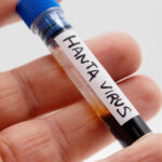 tanarul din arad confirmat cu hantavirus a fost externat 6a0f051a75bfc