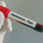 video tanarul din arad suspect de hantavirus a fost confirmat pozitiv ce spun autoritatile despre tulpina virusului 6a0adbe21e552