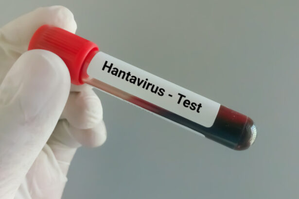 video tanarul din arad suspect de hantavirus a fost confirmat pozitiv ce spun autoritatile despre tulpina virusului 6a0adbe21e552