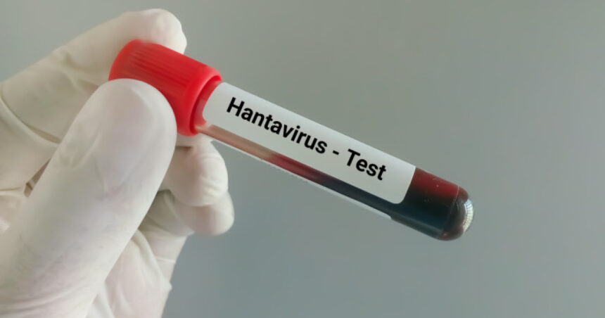video tanarul din arad suspect de hantavirus a fost confirmat pozitiv ce spun autoritatile despre tulpina virusului 6a0adbe21e552