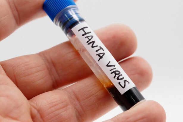 ancheta epidemiologica in argentina noua varianta de hantavirus identificata la rozatoare fara legatura cu focarul de pe mv hondius 6a42b5e91fc4b