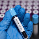 doi oameni de stiinta acuzati ca au adus ilegal in sua fiole cu virus mpox dezactivat din africa si au mintit autoritatile 6a214fee9369c