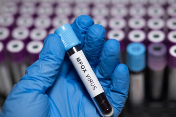 doi oameni de stiinta acuzati ca au adus ilegal in sua fiole cu virus mpox dezactivat din africa si au mintit autoritatile 6a214fee9369c