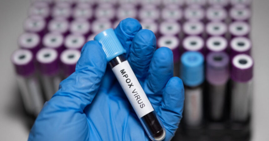 doi oameni de stiinta acuzati ca au adus ilegal in sua fiole cu virus mpox dezactivat din africa si au mintit autoritatile 6a214fee9369c