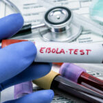 virusul ebola poate ramane ascuns in organism luni sau ani cum poate reaparea infectia studiu 6a367278d8bca