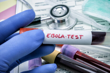 virusul ebola poate ramane ascuns in organism luni sau ani cum poate reaparea infectia studiu 6a367278d8bca