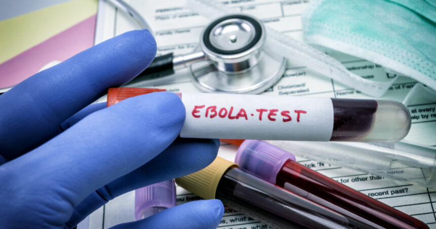 virusul ebola poate ramane ascuns in organism luni sau ani cum poate reaparea infectia studiu 6a367278d8bca