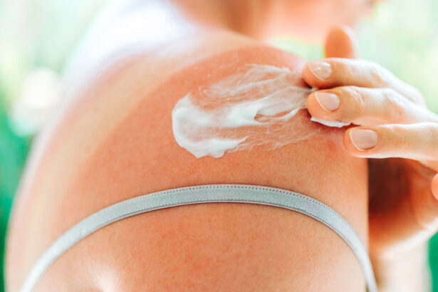 ce face o crema cu spf sa fie cu adevarat eficienta dermatologii explica cum poate contribui la reducerea riscului de cancer de piele 6a51c69603e77